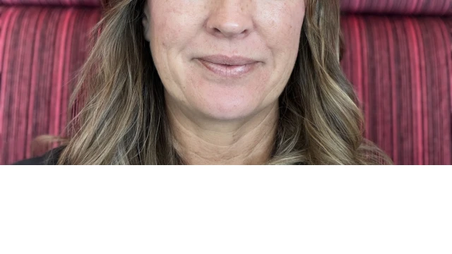 Kate thumb